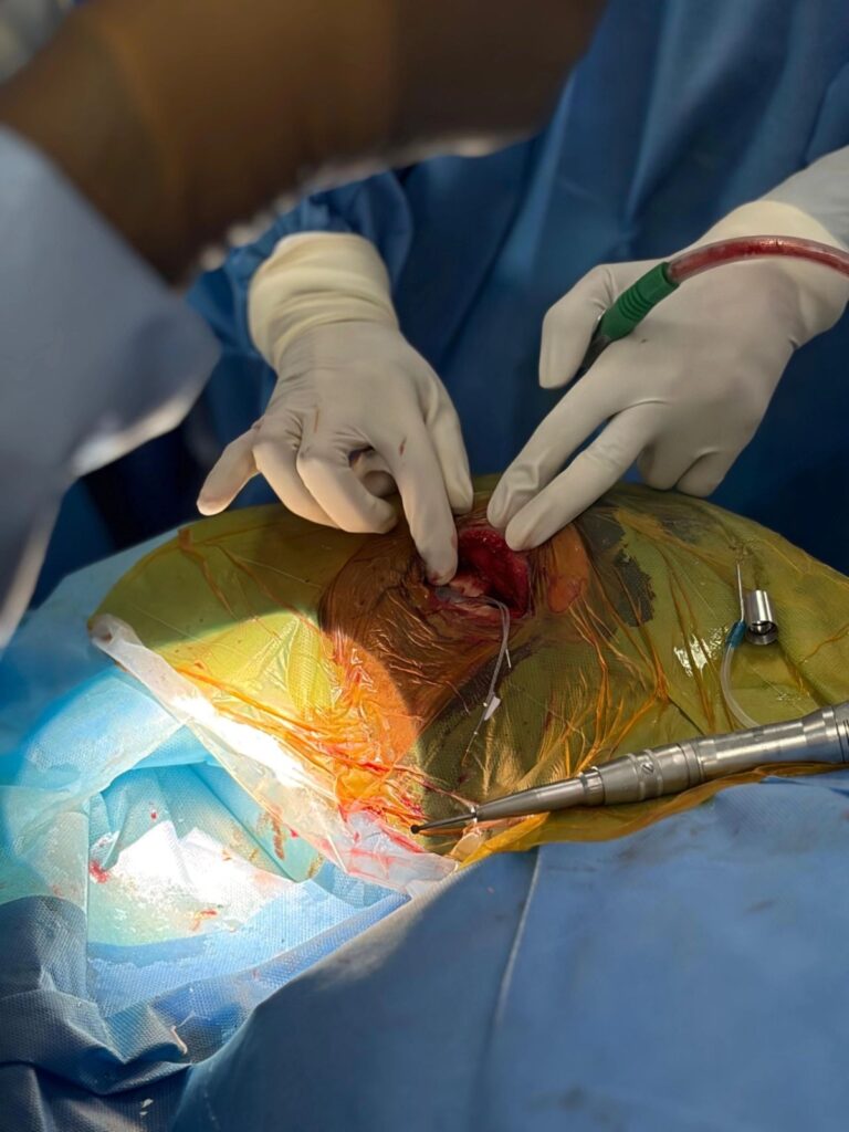 CMRI Introduces World’s First Smart Cochlear Implant in Eastern India